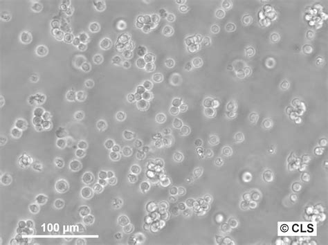 Jurkat cells .